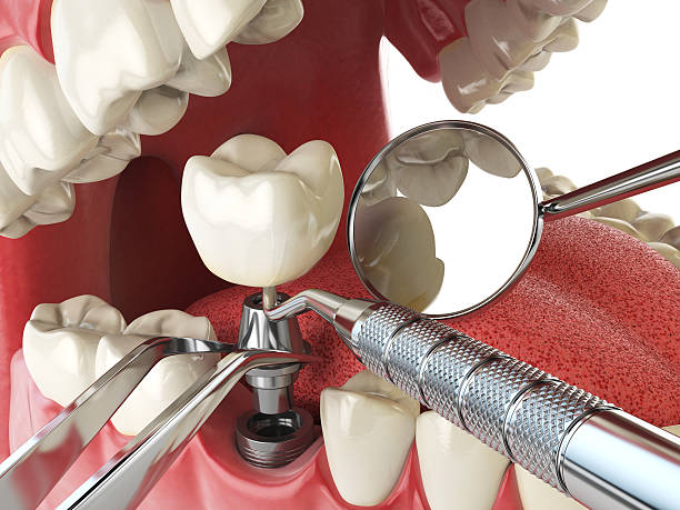 Best Same-Day Emergency Dental Services in Ly Lake, IL