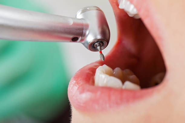 Best Weekend Emergency Dentist in Ly Lake, IL